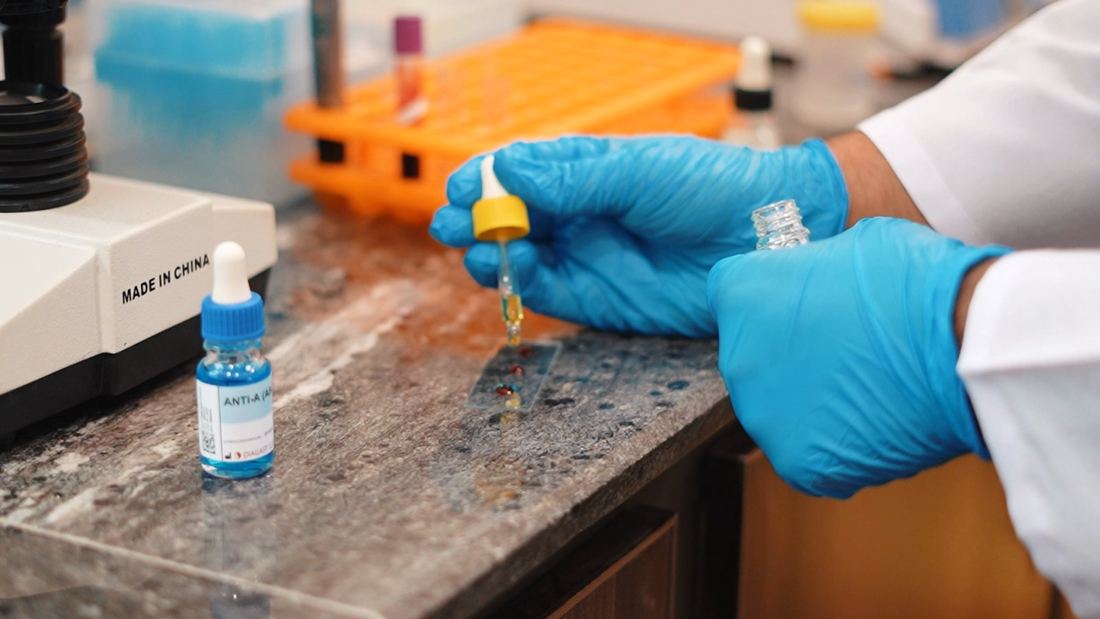 Sample testing